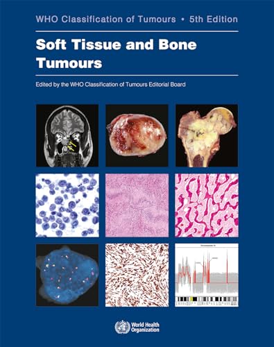 Soft Tissue and Bone Tumours: Who Classification of Tumours (World Health Organization Classification of Tumours, 3, Band 3)