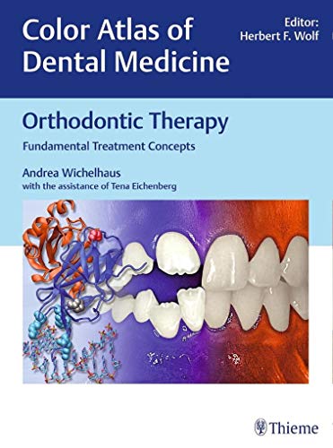 Orthodontic Therapy: Fundamental Treatment Concepts (Color Atlas of Dental Medicine)