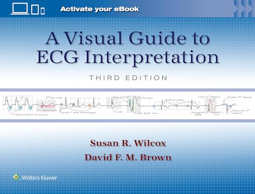 A Visual Guide to ECG Interpretation: Print + eBook with Multimedia von Lippincott Williams&Wilki