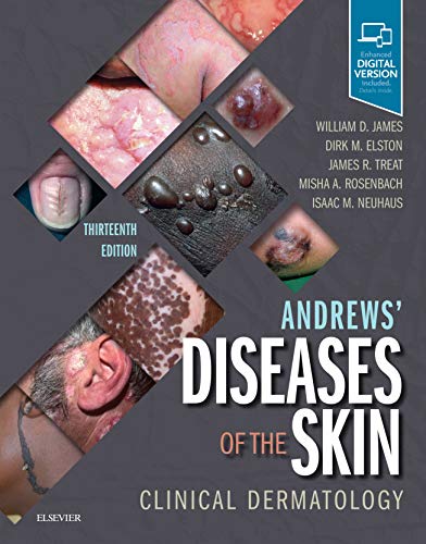 Andrews' Diseases of the Skin: Clinical Dermatology von Elsevier