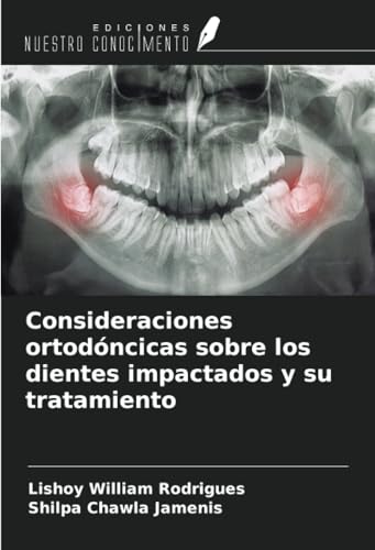 Consideraciones ortodóncicas sobre los dientes impactados y su tratamiento von Ediciones Nuestro Conocimiento