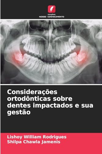 Considerações ortodônticas sobre dentes impactados e sua gestão von Edições Nosso Conhecimento