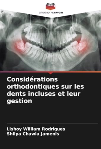 Considérations orthodontiques sur les dents incluses et leur gestion von Editions Notre Savoir