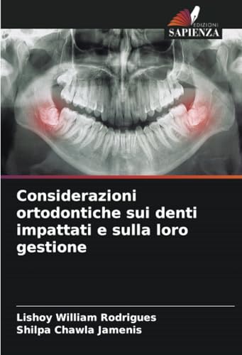 Considerazioni ortodontiche sui denti impattati e sulla loro gestione von Edizioni Sapienza