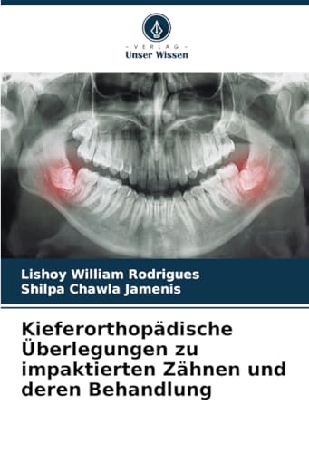 Kieferorthopädische Überlegungen zu impaktierten Zähnen und deren Behandlung von Verlag Unser Wissen