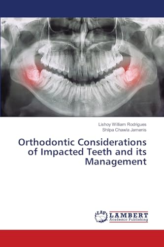 Orthodontic Considerations of Impacted Teeth and its Management von LAP Lambert Academic Publishing