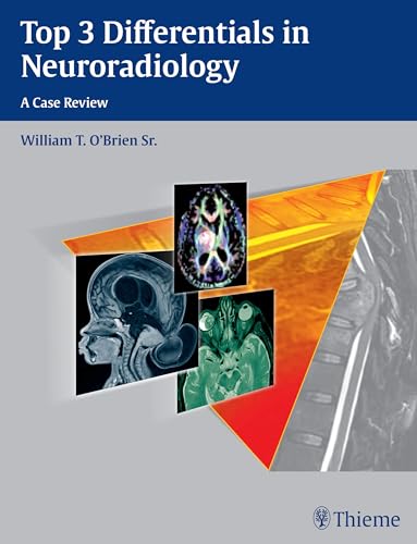 Top 3 Differentials in Neuroradiology von Thieme Medical Publishers