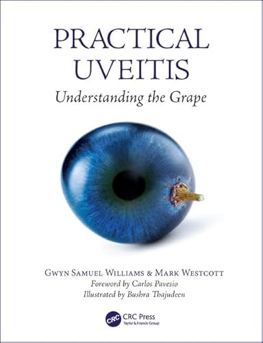 Practical Uveitis: Understanding the Grape von CRC Press