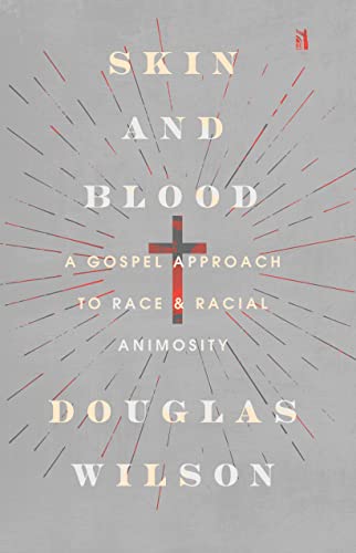Skin and Blood: A Gospel Approach to Race & Racial Animosity von Canon Press