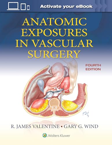 Anatomic Exposures in Vascular Surgery von WOLTERS KLUWER HEALTH