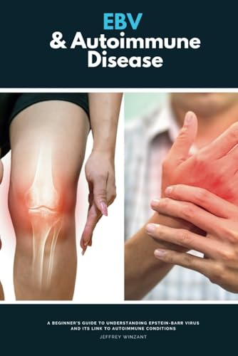 EBV & Autoimmune Disease: A Beginner’s Guide to Understanding Epstein-Barr Virus and Its Link to Autoimmune Conditions von Independently published