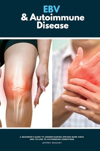 EBV & Autoimmune Disease: A Beginner's Guide to Understanding Epstein-Barr Virus and Its Link to Autoimmune Conditions von mindplusfood