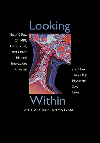 Looking Within: How X-Ray, CT, MRI, Ultrasound, and Other Medical Images Are Created, and How They Help Physicians Save Lives von University of California Press