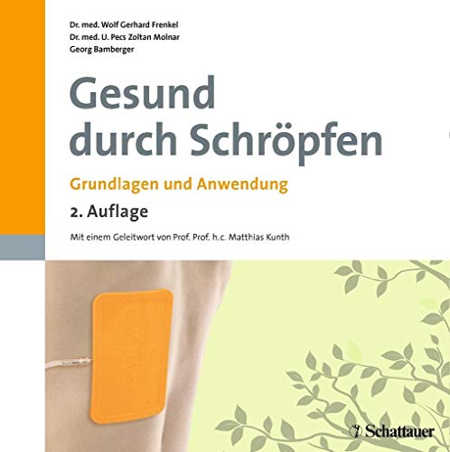 Gesund durch Schröpfen: Grundlagen und Anwendung