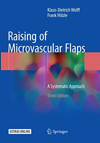 Raising of Microvascular Flaps: A Systematic Approach von Springer