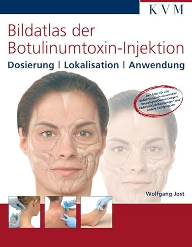Bildatlas der Botulinumtoxin-Injektion: Dosierung / Lokalisation / Anwendung Bildatlas der Botulinumtoxin-Injektion: Dosierung / Lokalisation / Anwendung