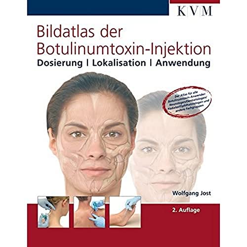Bildatlas der Botulinumtoxin-Injektion: Dosierung, Lokalisation, Anwendung