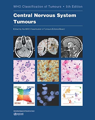 Central Nervous System Tumours: Who Classification of Tumours (WHO Classification of Tumours, 6) von IARC