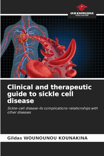 Clinical and therapeutic guide to sickle cell disease: Sickle-cell disease-its complications-relationships with other diseases von Our Knowledge Publishing