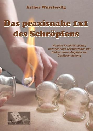 Das praxisnahe 1 x 1 des Schröpfens
