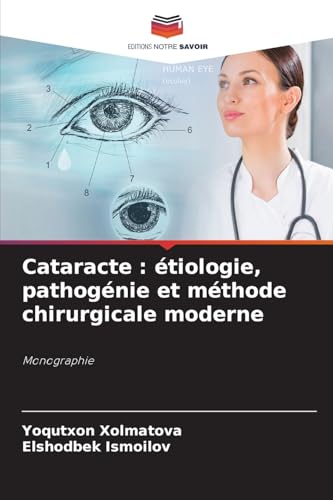 Cataracte : étiologie, pathogénie et méthode chirurgicale moderne: Monographie von Editions Notre Savoir
