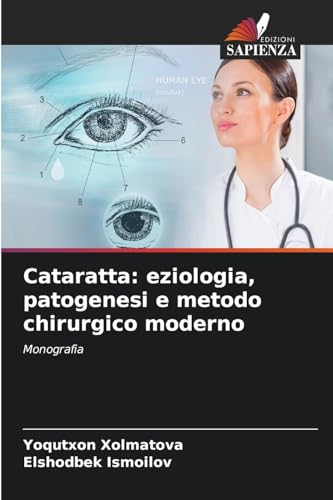 Cataratta: eziologia, patogenesi e metodo chirurgico moderno: Monografia von Edizioni Sapienza