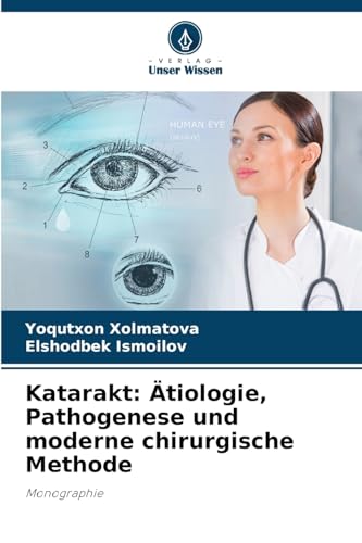 Katarakt: Ätiologie, Pathogenese und moderne chirurgische Methode: Monographie von Verlag Unser Wissen