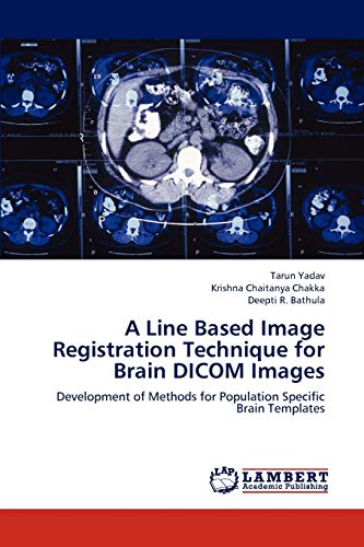 A Line Based Image Registration Technique for Brain DICOM Images: Development of Methods for Population Specific Brain Templates von LAP Lambert Academic Publishing