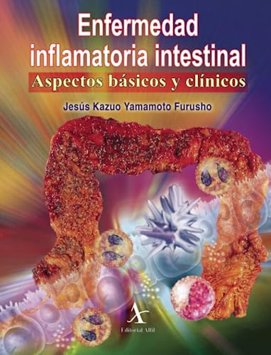Enfermedad inflamatoria intestinal: Aspectos básicos y clínicos von -99999