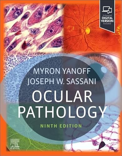 Ocular Pathology von Elsevier