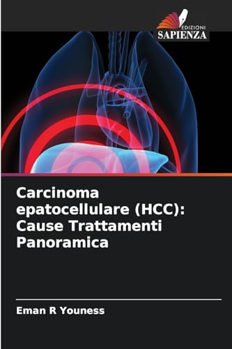 Carcinoma epatocellulare (HCC): Cause Trattamenti Panoramica: DE von Edizioni Sapienza