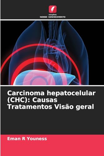 Carcinoma hepatocelular (CHC): Causas Tratamentos Visão geral: DE