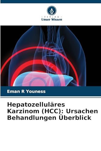 Hepatozelluläres Karzinom (HCC): Ursachen Behandlungen Überblick: DE von Verlag Unser Wissen