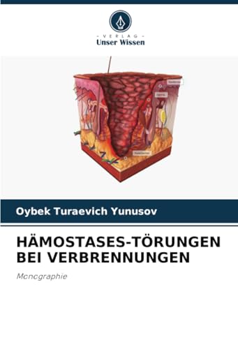 HÄMOSTASES-TÖRUNGEN BEI VERBRENNUNGEN: Monographie HÄMOSTASES-TÖRUNGEN BEI VERBRENNUNGEN: Monographie von Verlag Unser Wissen
