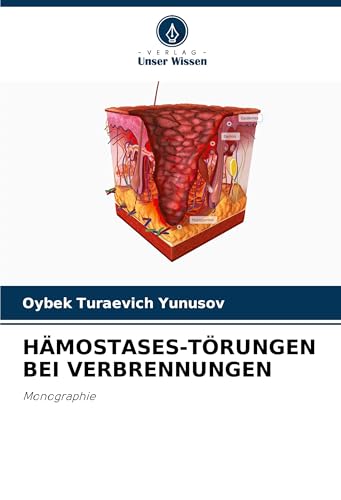HÄMOSTASES-TÖRUNGEN BEI VERBRENNUNGEN: Monographie von Verlag Unser Wissen