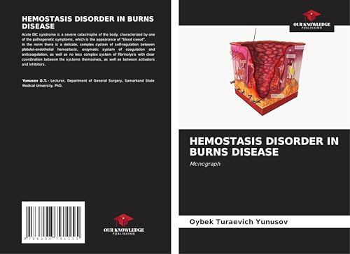 HEMOSTASIS DISORDER IN BURNS DISEASE: Monograph von Our Knowledge Publishing