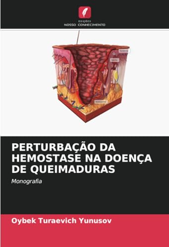 PERTURBAÇÃO DA HEMOSTASE NA DOENÇA DE QUEIMADURAS: Monografia von Edições Nosso Conhecimento