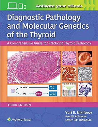 Diagnostic Pathology and Molecular Genetics of the Thyroid: A Comprehensive Guide for Practicing Thyroid Pathology von WOLTERS KLUWER HEALTH