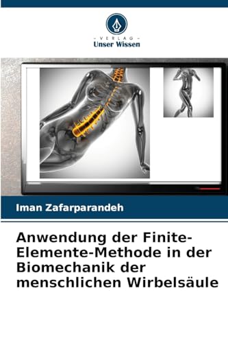 Anwendung der Finite-Elemente-Methode in der Biomechanik der menschlichen Wirbelsäule