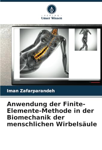 Anwendung der Finite-Elemente-Methode in der Biomechanik der menschlichen Wirbelsäule Anwendung der Finite-Elemente-Methode in der Biomechanik der menschlichen Wirbelsäule