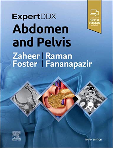 ExpertDDx: Abdomen and Pelvis von Elsevier