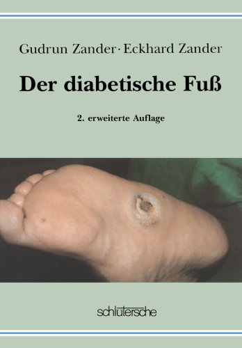 Der Diabetische Fuß