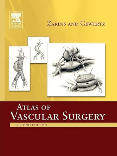 Atlas Of Vascular Surgery - Paperback Edition: Atlas Of Vascular Surgery - Paperback Edition von Churchill Livingstone