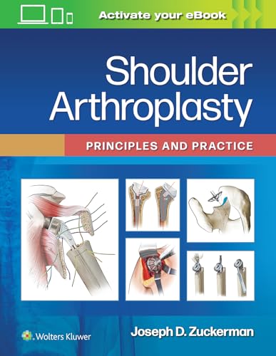 Shoulder Arthroplasty: Principles and Practice von Wolters Kluwer Health
