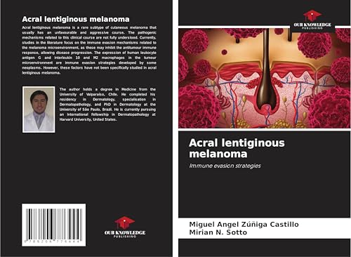 Acral lentiginous melanoma: Immune evasion strategies von Our Knowledge Publishing