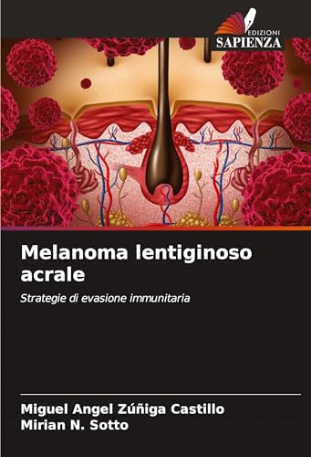 Melanoma lentiginoso acrale: Strategie di evasione immunitaria von Edizioni Sapienza