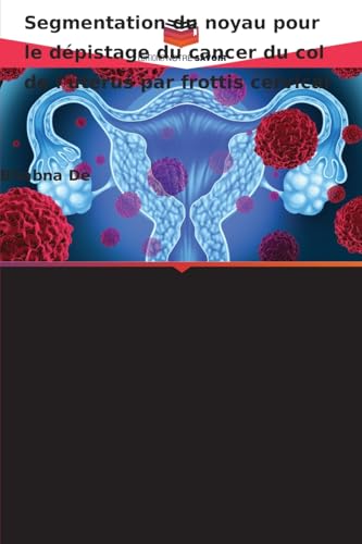 Segmentation du noyau pour le dépistage du cancer du col de l'utérus par frottis cervical von Editions Notre Savoir