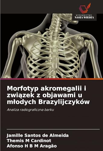 Morfotyp akromegalii i zwi¿zek z objawami u m¿odych Brazylijczyków: Analiza radiograficzna barku von Wydawnictwo Nasza Wiedza