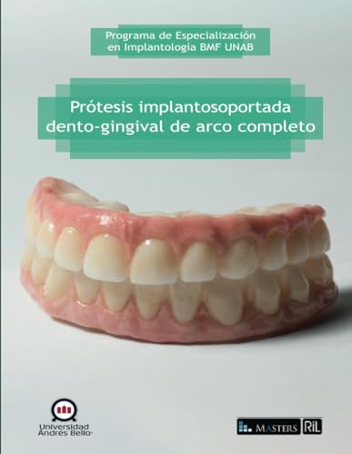 Prótesis implantosoportada dento-gingival de arco completo von RIL Editores