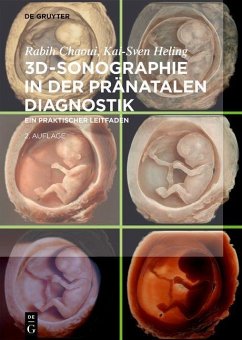 3D-Sonographie in der pränatalen Diagnostik von De Gruyter